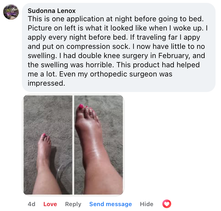 Miracle Balm Soothing Relief Cream Dry Skin Cracked Heels Irritation Moisturizer In Use
